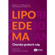 Lipoedema: Choroba grubych nóg. Podejście interdyscyplinarne - 06119b00218ks.jpg