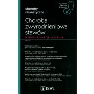 Choroba zwyrodnieniowa stawów - 12489000218ks.jpg