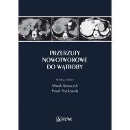 Przerzuty nowotworowe do wątroby - 14105900218ks.jpg