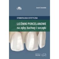 Licówki porcelanowe na zęby żuchwy i szczęki: Stomatologia estetyczna. - 15206703649ks.jpg