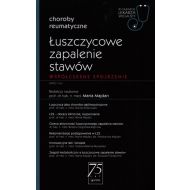 Łuszczycowe zapalenie stawów: Współczesne spojrzenie - 16218400218ks.jpg