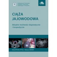 Ciąża jajowodowa Aktualne możliwości diagnostyczne i terapeutyczne - 22092903649ks.jpg