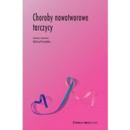 Choroby nowotworowe tarczycy - 22191702434ks.jpg