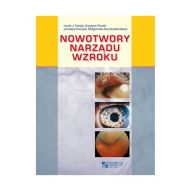 Nowotwory narządu wzroku - 22408203091ks.jpg