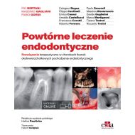 Powtórne leczenie endodontyczne - 22920403649ks.jpg