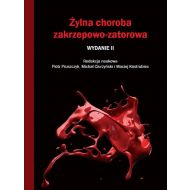 Żylna choroba zakrzepowo-zatorowa - 23846202434ks.jpg