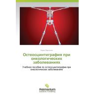 Osteostsintigrafiya Pri Onkologicheskikh Zabolevaniyakh - 238gjc03527ks.jpg