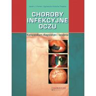 Choroby infekcyjne oczu: Kompendium diagnostyki i leczenia - 24034803091ks.jpg