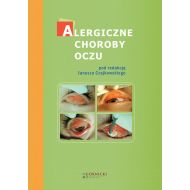 Alergiczne choroby oczu - 24052703091ks.jpg