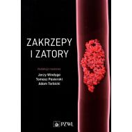 Zakrzepy i zatory - 25737800218ks.jpg