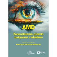 AMD Zwyrodnienie plamki żółtej związane z wiekiem - 27681b00218ks.jpg