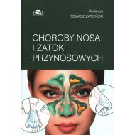 Choroby nosa i zatok przynosowych - 47552a03649ks.jpg