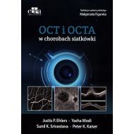 OCT i OCTA w chorobach siatkówki - 52551a03649ks.jpg