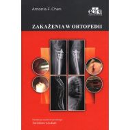 Zakażenia w ortopedii - 53292a03649ks.jpg