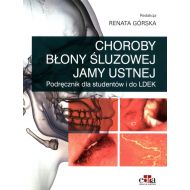 Choroby błony śluzowej jamy ustnej - 55772a03649ks.jpg