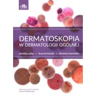 Dermatoskopia w dermatologii ogólnej - 59020a03649ks.jpg