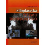 Alloplastyka stawu biodrowego - 636803i.jpg