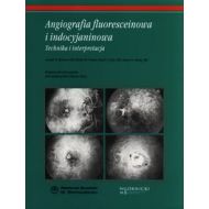 Angiografia fluoresceinowa i indocyjaninowa: Technika i interpretacja - 636855i.jpg