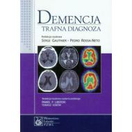 Demencja: Trafna Diagnoza - 642989i.jpg