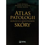 Atlas patologii złośliwych nowotworów skóry - 664121i.jpg