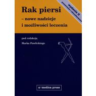 Rak piersi nowe nadzieje i możliwości leczenia - 805739i.jpg