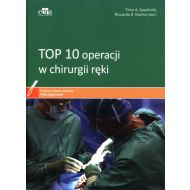 TOP 10 operacji w chirurgii ręki - 82282a03649ks.jpg