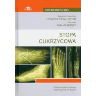 Stopa cukrzycowa - 84346a03649ks.jpg