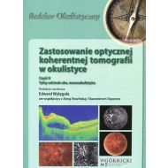 Zastosowanie optycznej koherentnej tomografii w okulistyce Część 2: Tylny odcinek oka, neurookulistyka - 879358i.jpg