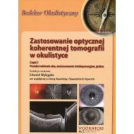 Zastosowanie optycznej koherentnej tomografii w okulistyce Część 1: Przedni odcinek oka, zastosowanie śródoperacyjne, jaskra - 879411i.jpg