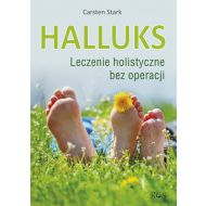 Halluks: Leczenie holistyczne bez operacji - 927037i.jpg