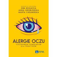 Alergie oczu. Ilustrowane kompendium dla praktyków - 93546a00218ks.jpg