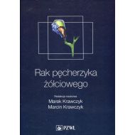 Rak pęcherzyka żółciowego - 939071i.jpg