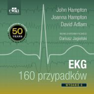 EKG 160 przypadków - 94795b03649ks.jpg