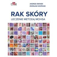 Rak skóry Leczenie metodą Mohsa - 98796303649ks.jpg