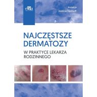 Najczęstsze dermatozy w praktyce lekarza rodzinnego - 99187303649ks.jpg