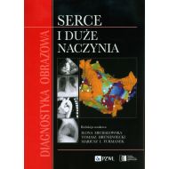 Diagnostyka obrazowa Serce i duże naczynia - 99661a00218ks.jpg