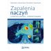 Zapalenia naczyń w praktyce klinicznej interdyscyplinarnie: Diagnostyka i leczenie