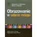 Obrazowanie w udarze mózgu