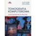 Tomografia komputerowa Zastosowanie kliniczne